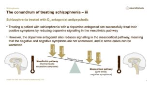 Schizophrenia – Neurobiology and Aetiology – slide 29